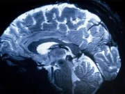 Badania wykazały, że porażenie prądem mózgu może sprawić, że ludzie będą mniej samolubni