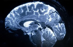 Badania wykazały, że porażenie prądem mózgu może sprawić, że ludzie będą mniej samolubni